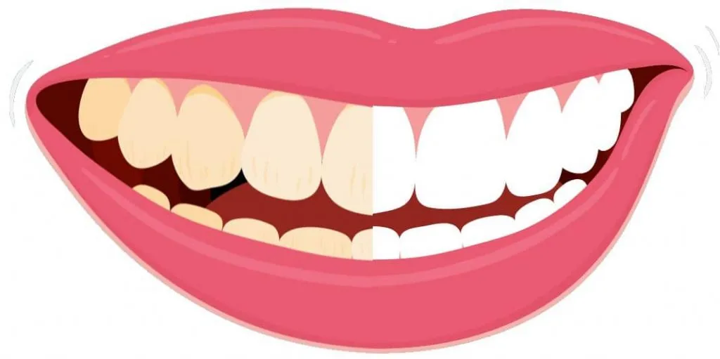 whiten Teeth Naturally