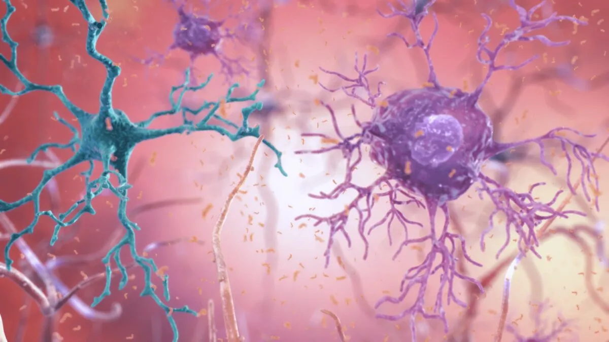 damaged neurons