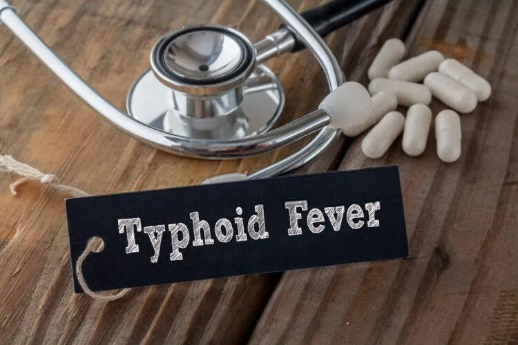 Typhoid fever as a communicable disease