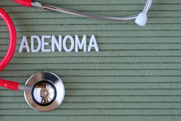 A complete guide for Adenoma