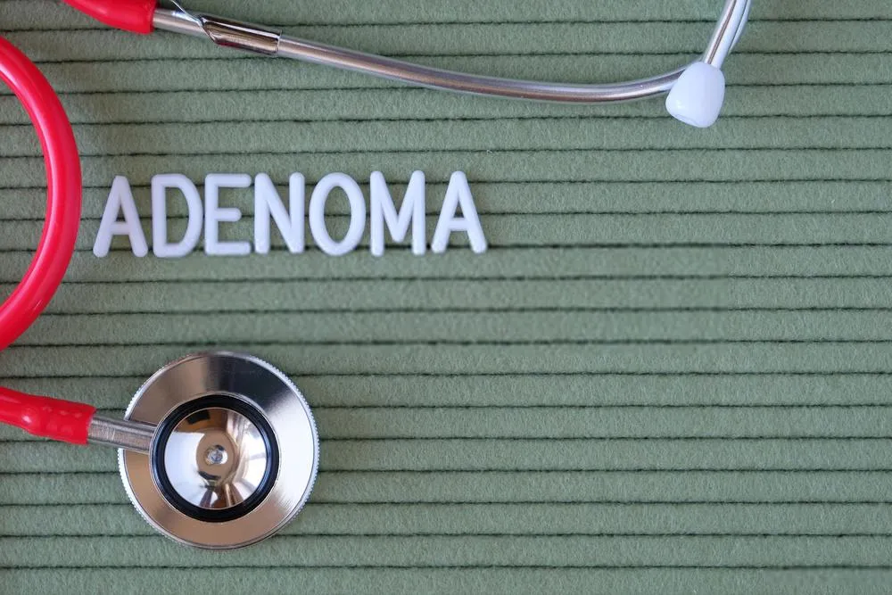 A complete guide for Adenoma