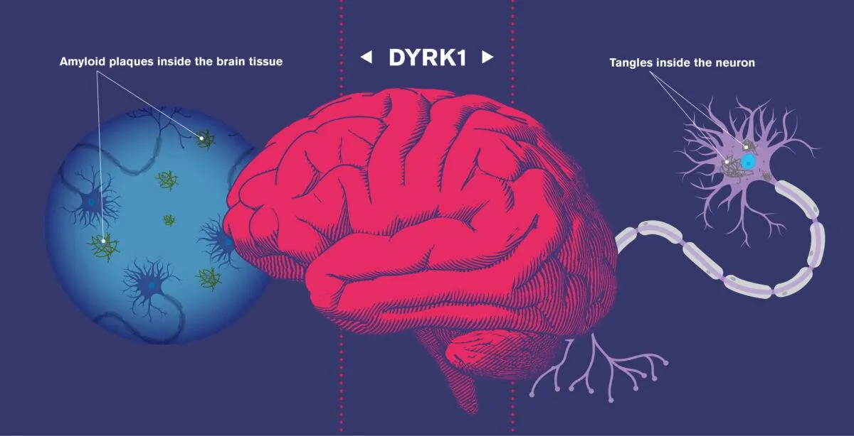 Alzheimer's Disease Pathophysiology