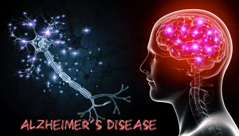 Alzheimer's Disease