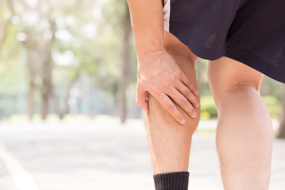 Calf pain can be a feature of Thromboangitis obliterans
