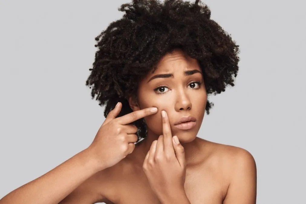 Tips To Deal With Acne 2