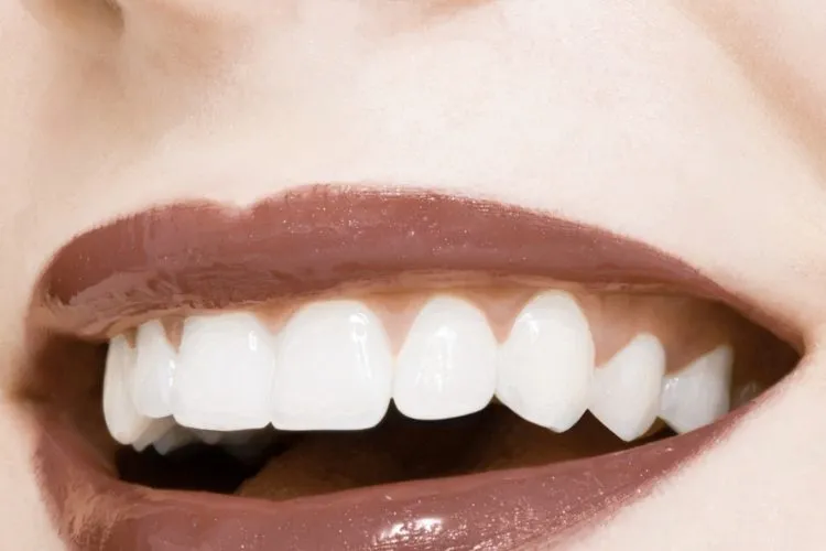 How Quickly Do Braces Work