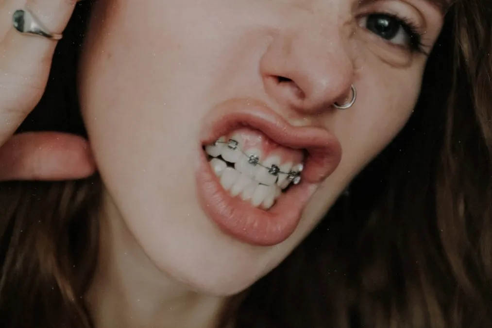 Celebrate Dental And Braces