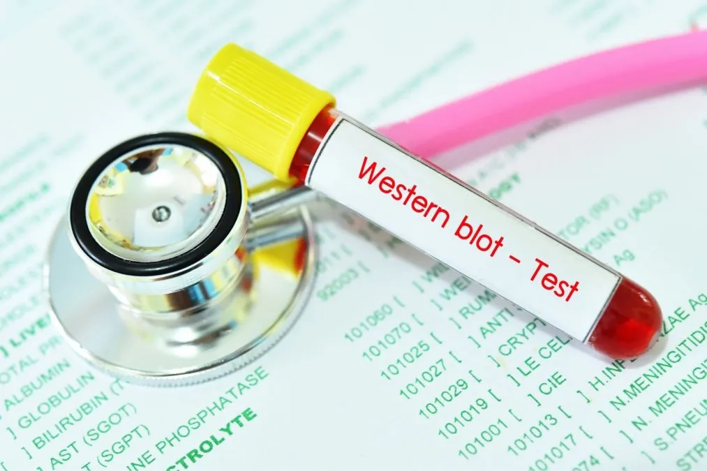 Biotechniques Explains The Basics Of Western Blotting