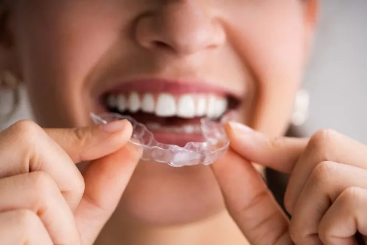 Plastic Aligner Trays Are Less Likely To Break
