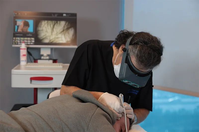 DHI method (FUE performed with Choi implanters)